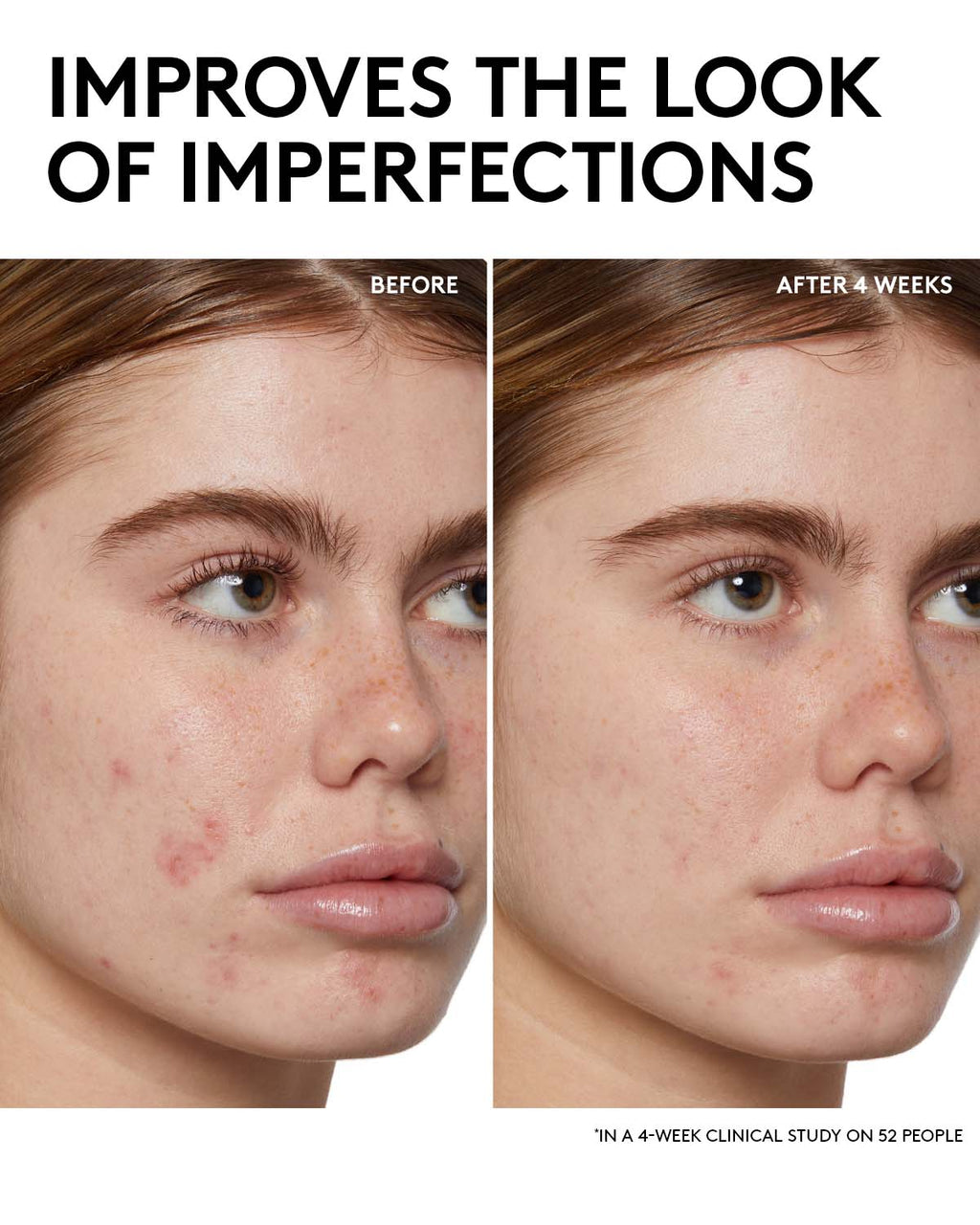 Fenty Skin Start’rs Full-Size Bundle: Oily Skin Edition